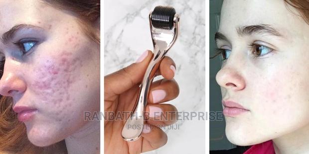 Derma Roller · Photo 3
