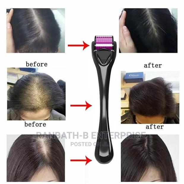 Derma Hair Roller System (0.5mm) · Photo 3