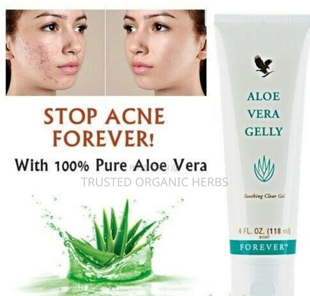 Stop Dark Spots Acne and Pimples · Photo 4