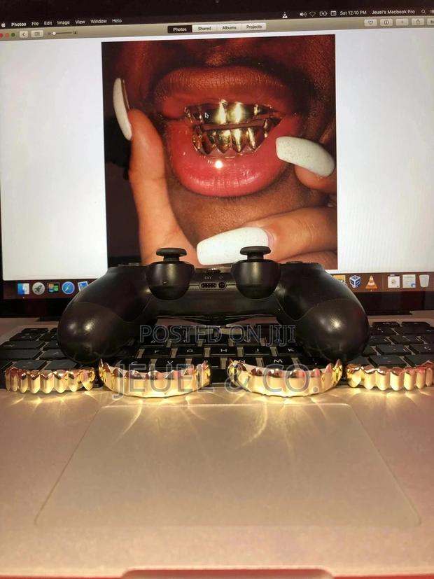 Original 14k Gold Grillz / Slugs photo 3