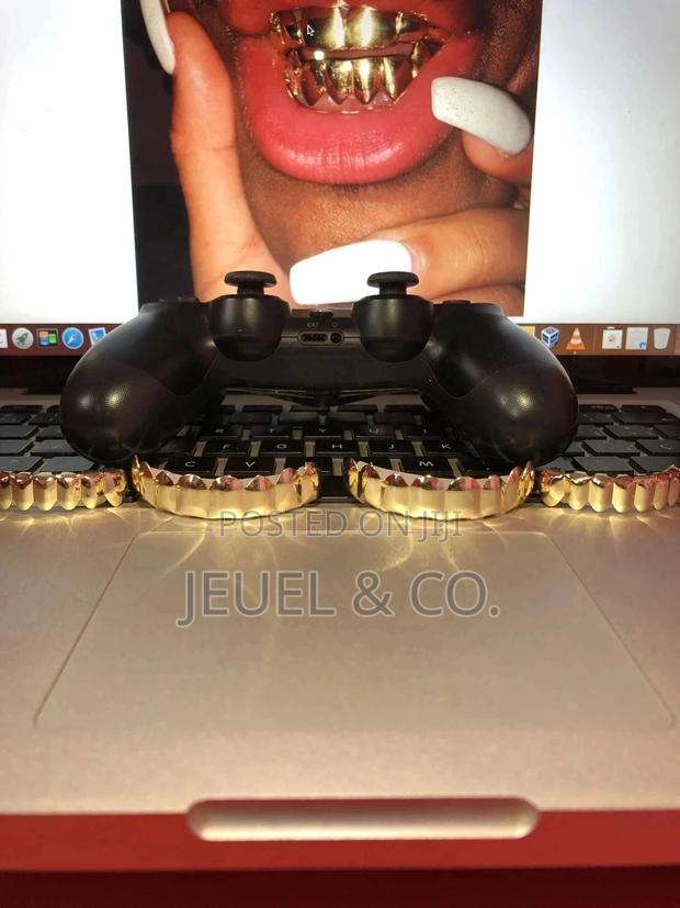 Original 14k Gold Grillz / Slugs photo 2