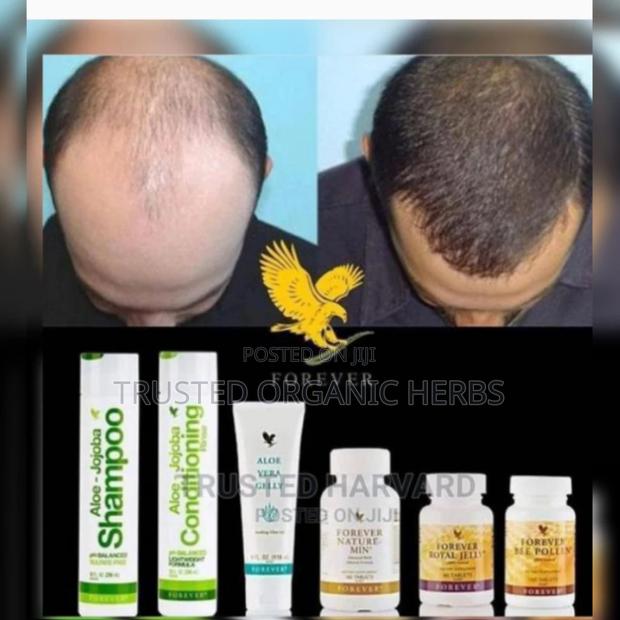 Baldness Or Hair Loss · Photo 2