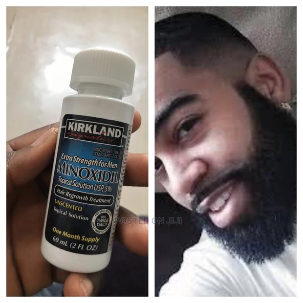 Leo Kirkland Minoxidil Oil · Photo 2