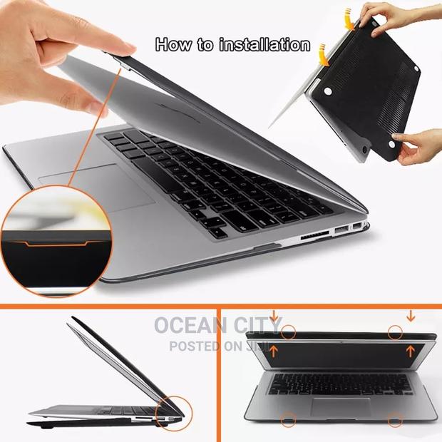 14” Macbook Case Bundle (3-in-1) · Photo 4