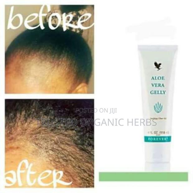 Hair Growth or Hair Loss Treatment · Photo 2