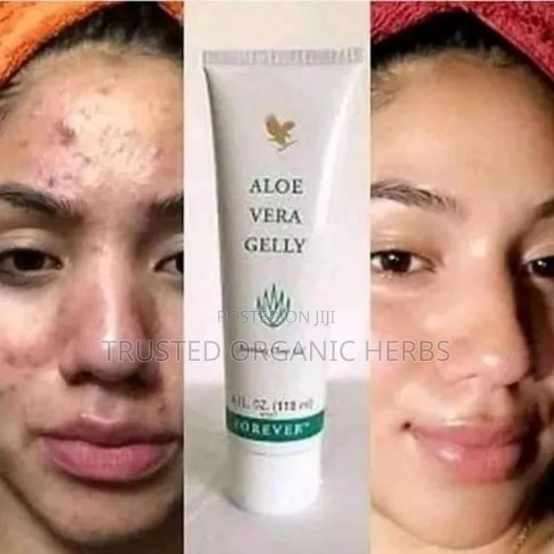 Forever Aloe Gelly - Soothes Clear Gel · Photo 2