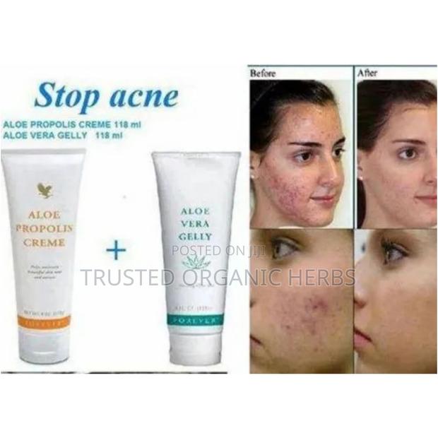 Forever Aloe Propolis Skincare · Photo 2