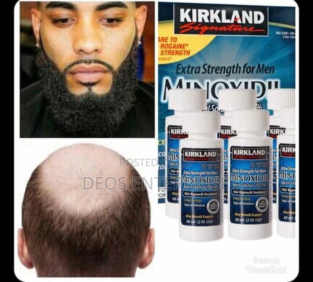 Kirkland Minoxibeard · Photo 4