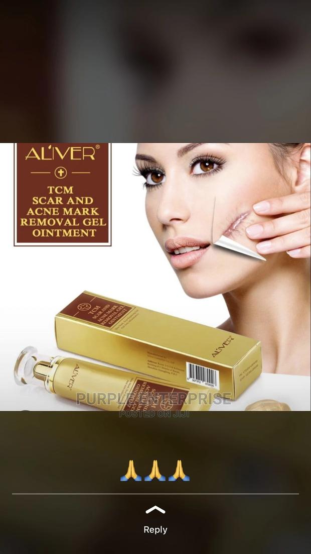TCM Scar Removal · Photo 2