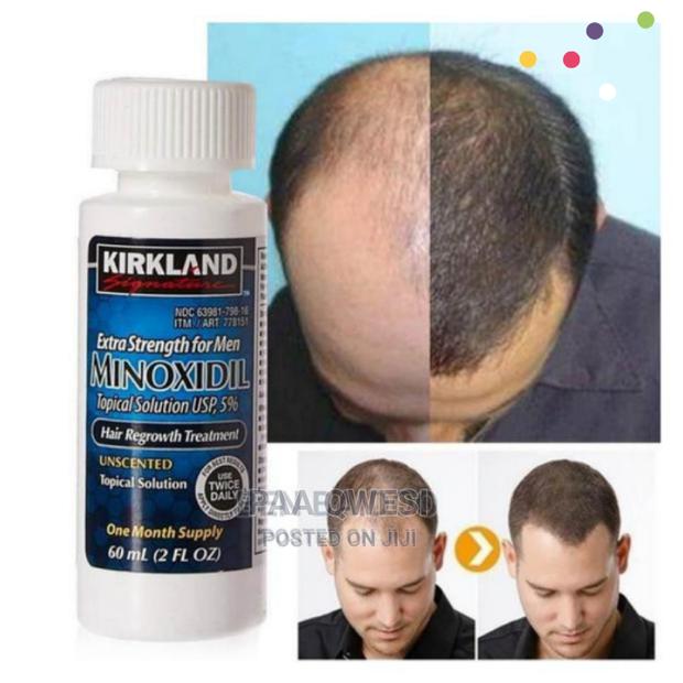 Original Kirkland Minoxidil · Photo 2