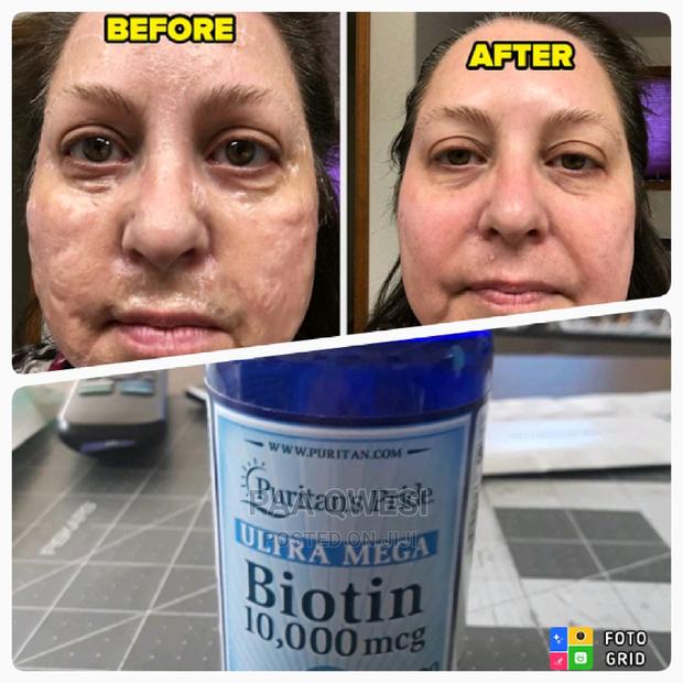 Utra Mega Biotin · Photo 2