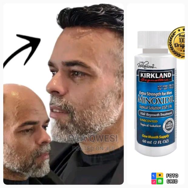 Undiluted Minoxidil · Photo 2