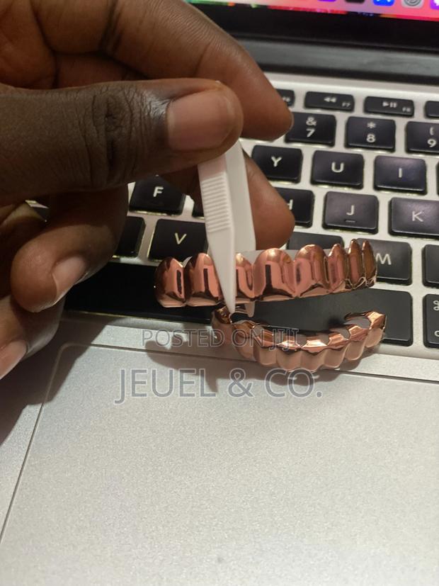 Original Rose Gold Grillz / Slugs photo 2