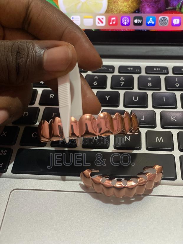 Original Rose Gold Grillz / Slugs photo 3
