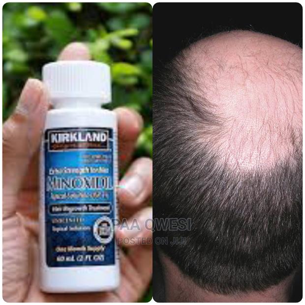 Kirkland Minoxidil (Original 100%) · Photo 2