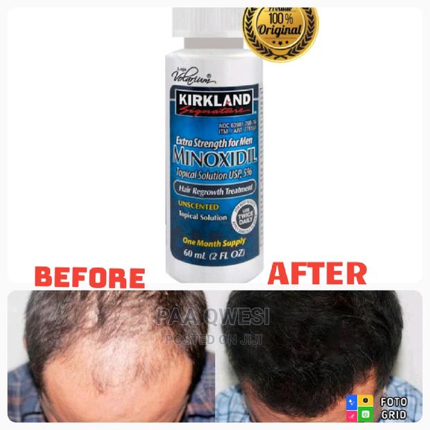 Kirkland Topical Solution. · Photo 2