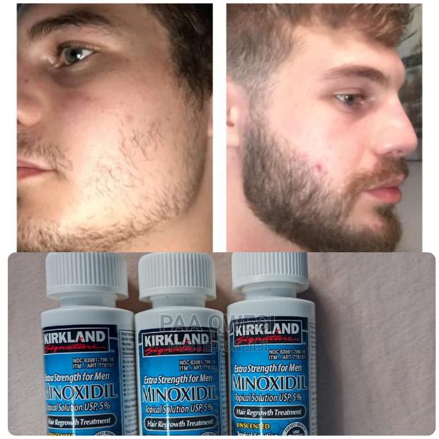 Kirkland Beard and Hairline Loss Oil. · Photo 2