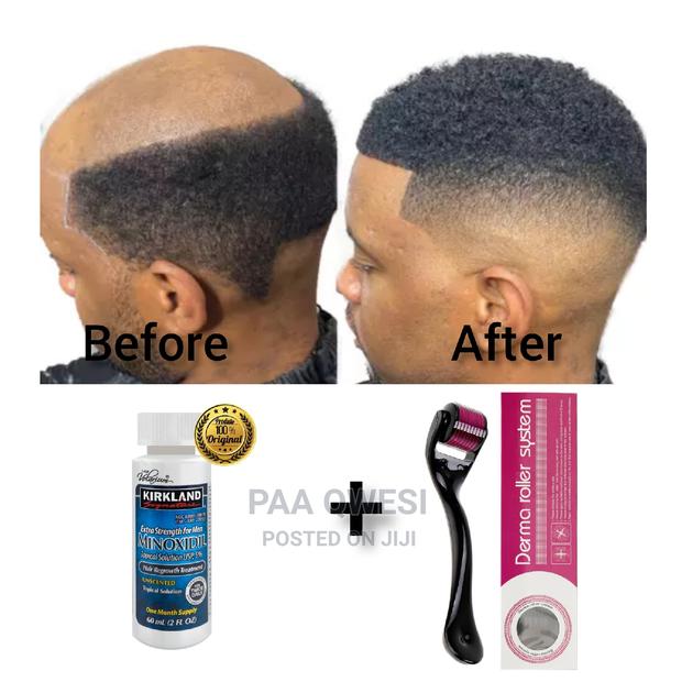 Derma Roller System Kirkland Undiluted Oil · Photo 2