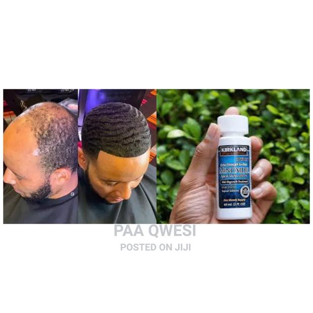 Kirkland Minoxidil Hair Growth Treatment · Photo 2