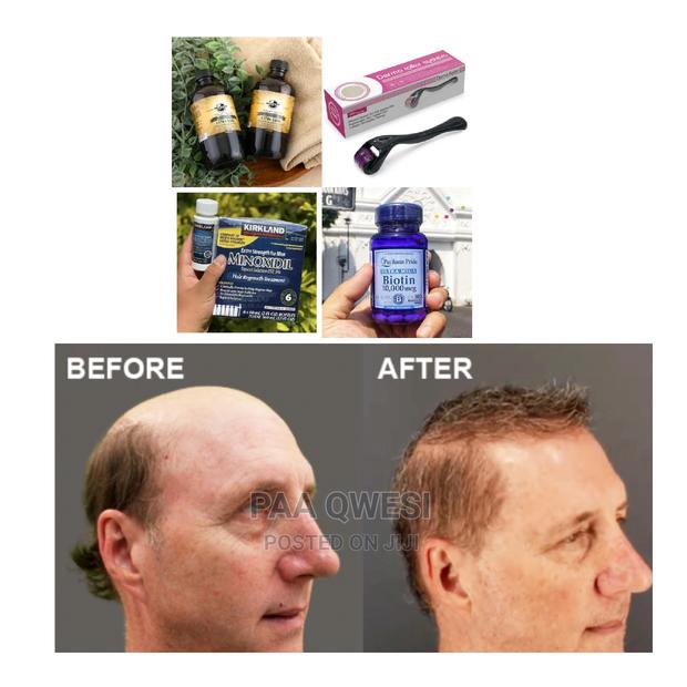 Jaimaca Castor Oil,Biotin,Derma Roller Kirkland{Utra} · Photo 2