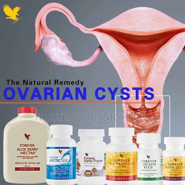 Natural Solution for Ovarian Cyst · Photo 2