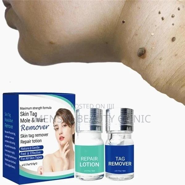 Medical Grade Skin Tag, Genital Wart and Mole Removal 2 in 1 · Photo 4