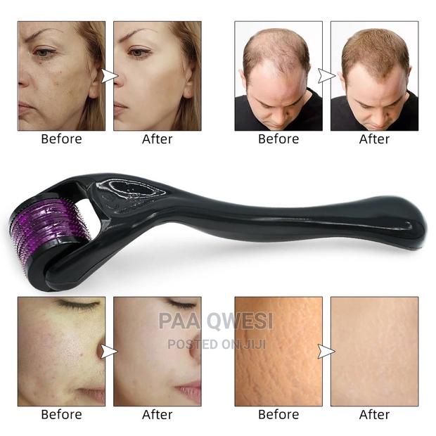 Derma Roller Growth Device {1.5mm} · Photo 2