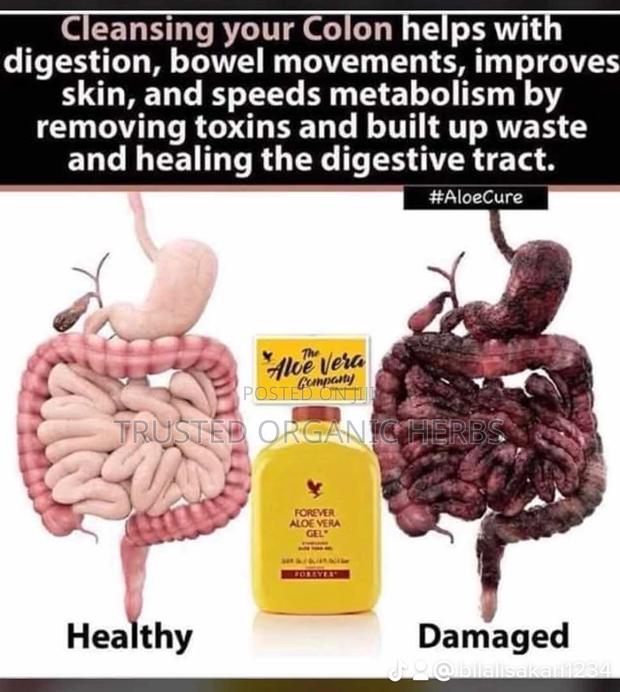 Toxins Remover and Detoxification From Forever Living · Photo 2