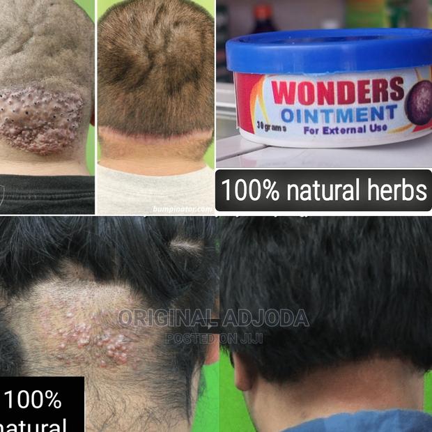 Wonders Ointment /Stubborn Razor Bumps · Photo 2