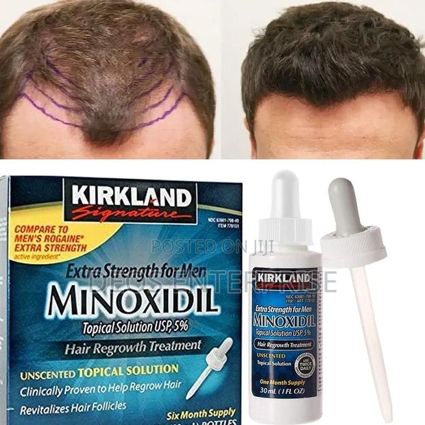 Kirkland Minoxidil Oil for Baldness · Photo 2