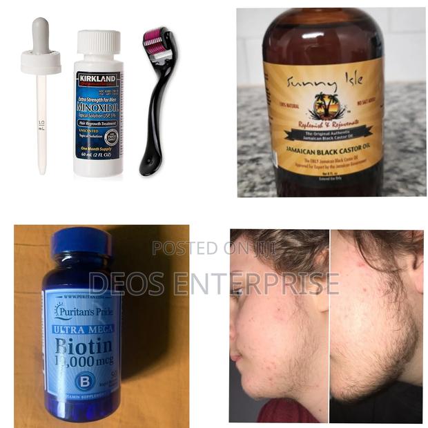 Combo for Hair Loss · Photo 2