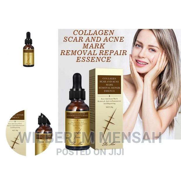 Collagen Scar Acne Removal Gel · Photo 3