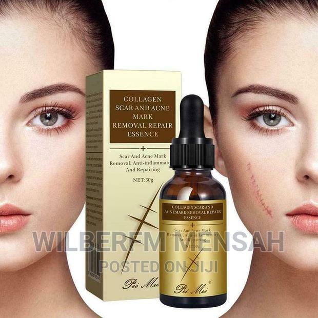 Collagen Scar Acne Removal Gel · Photo 4