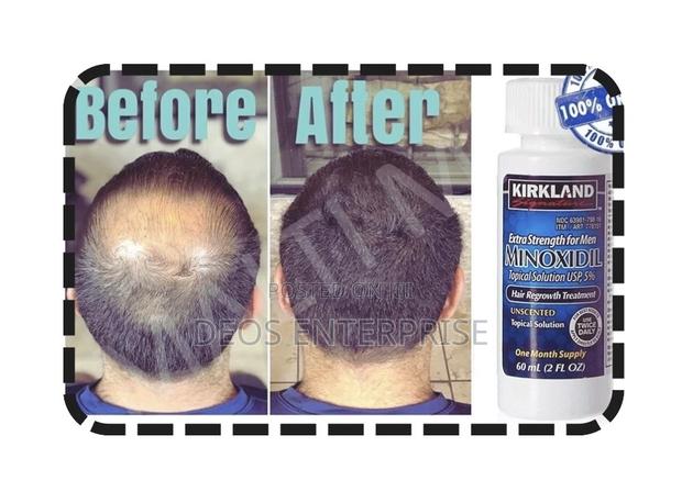 Kirkland Minoxidil Extra Strength for Beard Growth · Photo 2