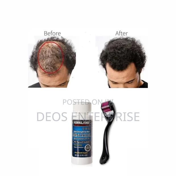 Beard,Hairline and Baldness Super Combo · Photo 2