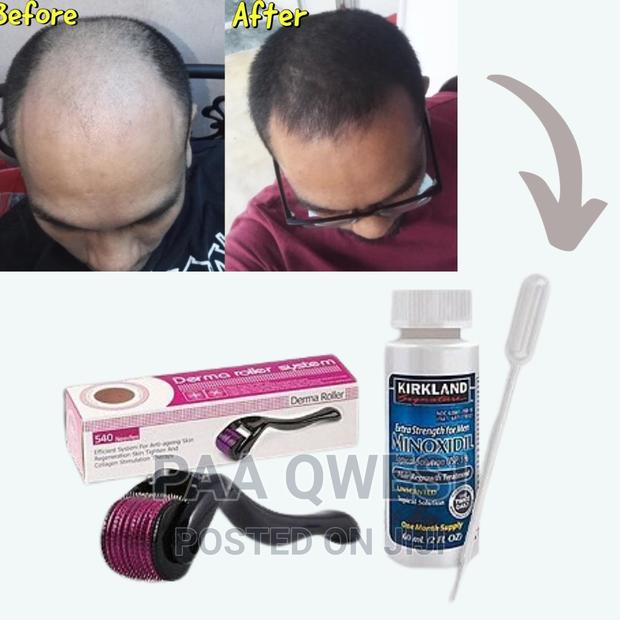Rapid Hair Regrowth Combo · Photo 2