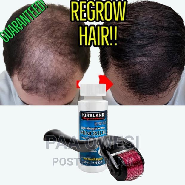 Men Hair Regrowth Product · Photo 2