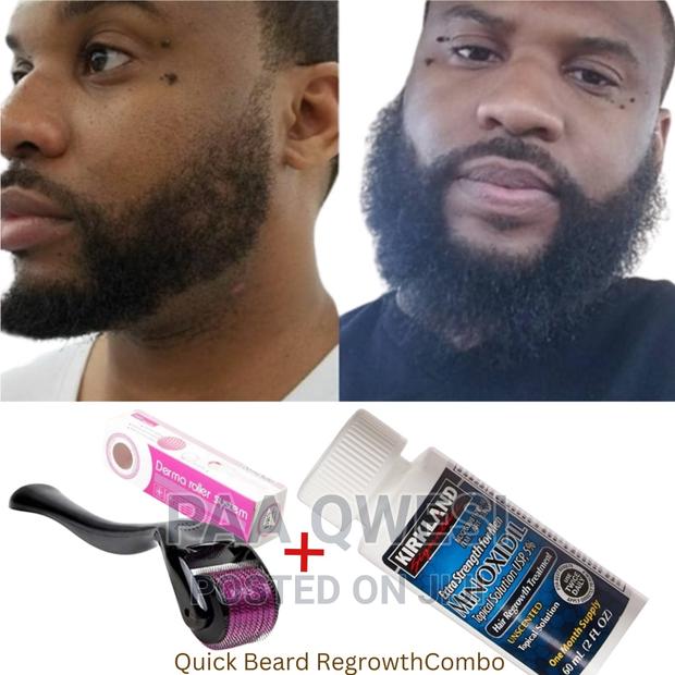 Beard Regrowth Product for Men. · Photo 2