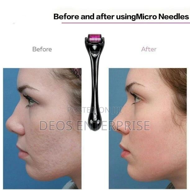 Derma Roller for Skin · Photo 2