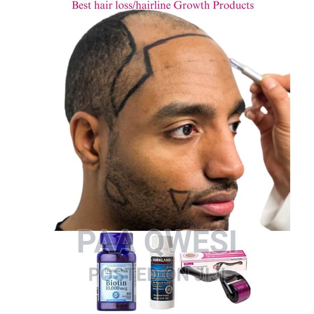 Rapid Hair Loss /Hairline Regrowth Products(Men) · Photo 2