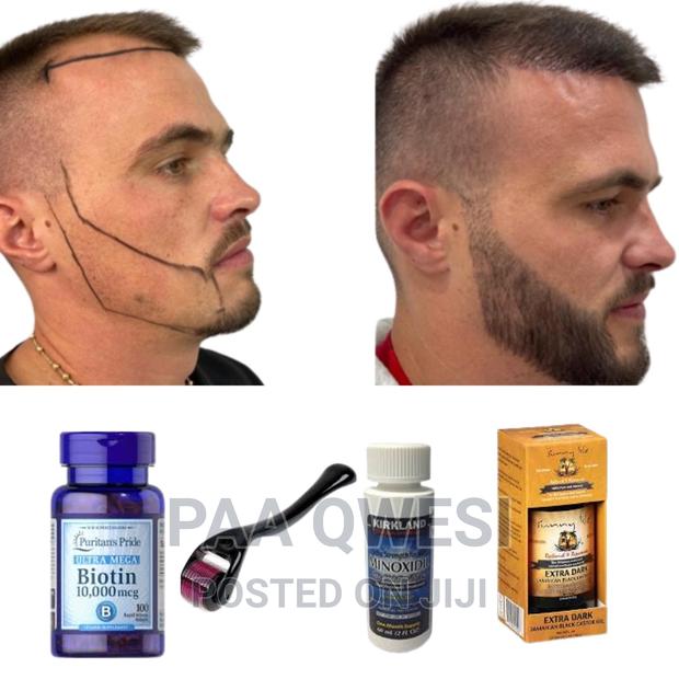 Hairline Loss Full Beard Growth Product {100% Guaranteed} · Photo 2