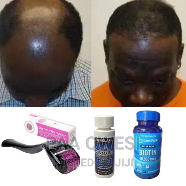 “Kirkland Minoxidil:The Ultimate Haircare Secret” · Photo 2