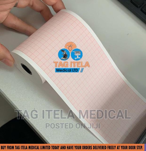 ECG Paper (Channel 3) · Photo 2
