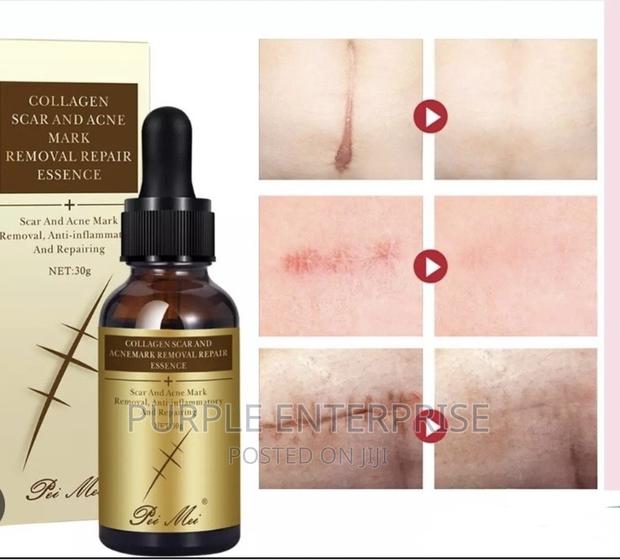TCM Scar Removal Oil · Photo 3