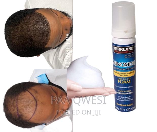 Kirkland Foam For Hair Growth · Photo 2