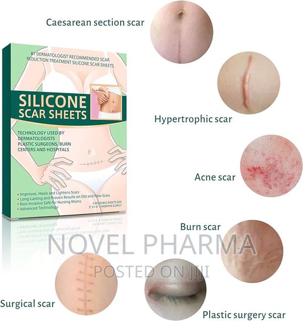 Silicone Scar Sheet
