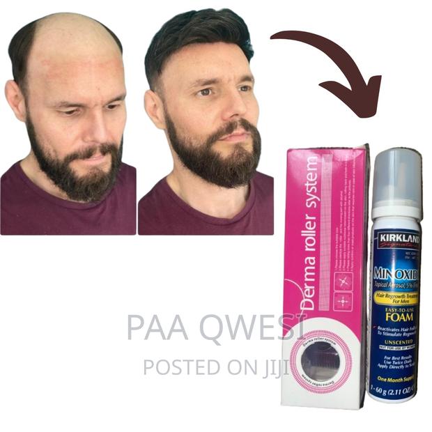 Super Combo for Baldness and Hairline Loss · Photo 2