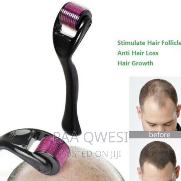 Derma Roller for Baldness Treatment · Photo 2