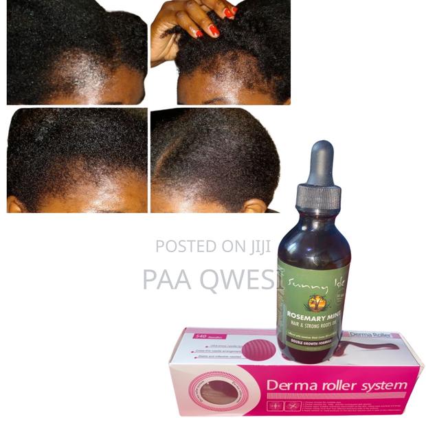 Rosemary Mint and Derma Roller · Photo 2