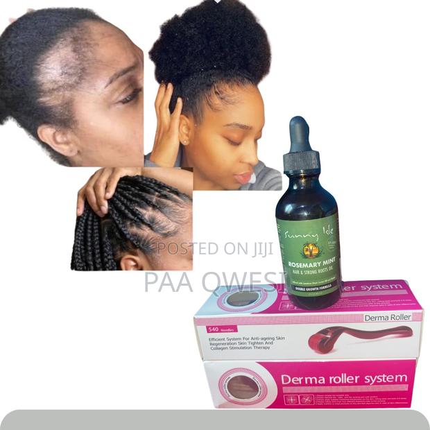 Derma Roller 1.5mm Rosemary Oil for Hair Edges · Photo 2
